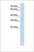 Anti-PHOX2A antibody produced in rabbit affinity isolated antibody