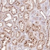 Anti-ZFYVE27 antibody produced in rabbit Prestige Antibodies&#174; Powered by Atlas Antibodies, affinity isolated antibody, buffered aqueous glycerol solution