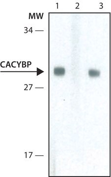 Anti-CACYBP antibody,Mouse monoclonal clone CABP7, purified from hybridoma cell culture