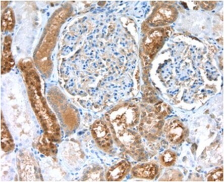 Anti-CASK Antibody, clone 2G5.1 clone 2G5.1, from mouse