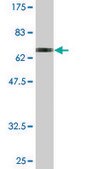 Monoclonal Anti-ENO3 antibody produced in mouse clone 3C6, purified immunoglobulin, buffered aqueous solution