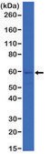 Anti-Cytokeratin 5 antibody, Rabbit monoclonal recombinant, expressed in HEK 293 cells, clone RM226, purified immunoglobulin