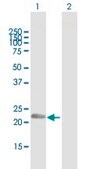 Anti-PLDN antibody produced in mouse IgG fraction of antiserum, buffered aqueous solution