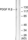 Anti-PDGFR &#946; antibody produced in rabbit affinity isolated antibody