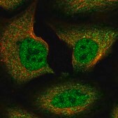 Anti-Spire1 antibody produced in rabbit Prestige Antibodies&#174; Powered by Atlas Antibodies, affinity isolated antibody, buffered aqueous glycerol solution