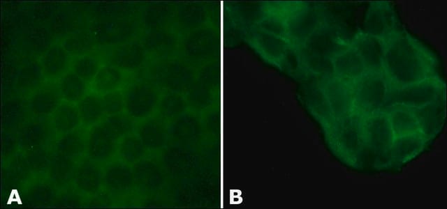 Anti-l-Afadin antibody produced in rabbit affinity isolated antibody, buffered aqueous solution