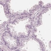 Anti-ELSPBP1 antibody produced in rabbit Prestige Antibodies&#174; Powered by Atlas Antibodies, affinity isolated antibody, buffered aqueous glycerol solution