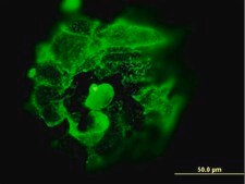 Monoclonal Anti-TP53 antibody produced in mouse clone 2C3, purified immunoglobulin, buffered aqueous solution