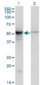 Monoclonal Anti-TUBB2A antibody produced in mouse clone 2B2, purified immunoglobulin, buffered aqueous solution
