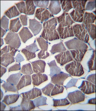 ANTI-NPHP3 (N-TERM) antibody produced in rabbit IgG fraction of antiserum, buffered aqueous solution
