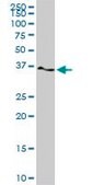 Monoclonal Anti-PTK9, (C-terminal) antibody produced in mouse clone 1E2, purified immunoglobulin, buffered aqueous solution