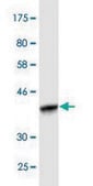 Monoclonal Anti-STC1, (C-terminal) antibody produced in mouse clone 1A3, purified immunoglobulin, buffered aqueous solution
