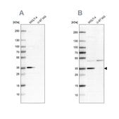 Anti-PCNA antibody produced in rabbit Prestige Antibodies® Powered by Atlas Antibodies, affinity isolated antibody, buffered aqueous glycerol solution, ab3
