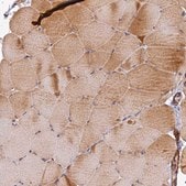 Anti-TANGO6 antibody produced in rabbit Prestige Antibodies&#174; Powered by Atlas Antibodies, affinity isolated antibody, buffered aqueous glycerol solution