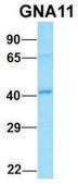 Anti-GNA11 (C-terminal) antibody produced in rabbit affinity isolated antibody