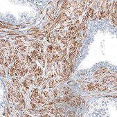 Anti-THY1 antibody produced in rabbit Prestige Antibodies&#174; Powered by Atlas Antibodies, affinity isolated antibody, buffered aqueous glycerol solution