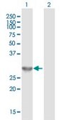 Anti-ING4 antibody produced in mouse IgG fraction of antiserum, buffered aqueous solution