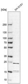 Anti-YKT6 antibody produced in rabbit Prestige Antibodies&#174; Powered by Atlas Antibodies, affinity isolated antibody, buffered aqueous glycerol solution, ab1