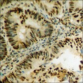 Anti-phospho-STAT5A (pSer780) antibody produced in rabbit affinity isolated antibody