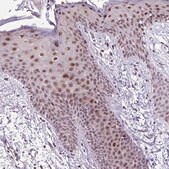 Anti-CLK2 antibody produced in rabbit Prestige Antibodies&#174; Powered by Atlas Antibodies, affinity isolated antibody, buffered aqueous glycerol solution