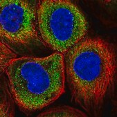 Anti-TRIM39 antibody produced in rabbit Prestige Antibodies&#174; Powered by Atlas Antibodies, affinity isolated antibody, buffered aqueous glycerol solution