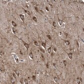 Anti-LYRM4 antibody produced in rabbit Prestige Antibodies® Powered by Atlas Antibodies, affinity isolated antibody, buffered aqueous glycerol solution