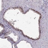 Anti-RSPH14 antibody produced in rabbit Prestige Antibodies&#174; Powered by Atlas Antibodies, affinity isolated antibody, buffered aqueous glycerol solution