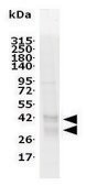 A2A (Adenosine Receptor A2A) recombinant, expressed in Sf9 cells