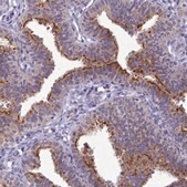 Anti-B9D2 antibody produced in rabbit Prestige Antibodies® Powered by Atlas Antibodies, affinity isolated antibody, buffered aqueous glycerol solution