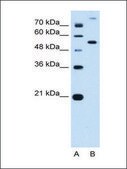 Anti-PPAT antibody produced in rabbit affinity isolated antibody
