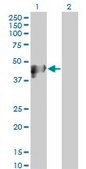 Monoclonal Anti-KRT17 antibody produced in mouse clone 2D10, purified immunoglobulin, buffered aqueous solution