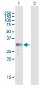 Anti-UCP2 antibody produced in mouse IgG fraction of antiserum, buffered aqueous solution