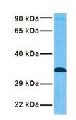 Anti-ADAMTS4 affinity isolated antibody
