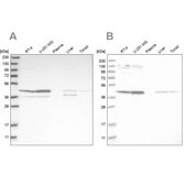 Anti-CNP antibody produced in rabbit Prestige Antibodies&#174; Powered by Atlas Antibodies, affinity isolated antibody, buffered aqueous glycerol solution, Ab2