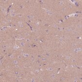 Anti-RFX4 antibody produced in rabbit Prestige Antibodies&#174; Powered by Atlas Antibodies, affinity isolated antibody, buffered aqueous glycerol solution