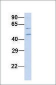 Anti-ZBTB7A antibody produced in rabbit affinity isolated antibody