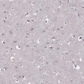 Anti-CD28 antibody produced in rabbit Prestige Antibodies&#174; Powered by Atlas Antibodies, affinity isolated antibody