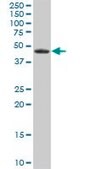 Anti-EPHX1 antibody produced in mouse purified immunoglobulin, buffered aqueous solution
