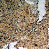 Anti-phospho-Fructose 6 Phosphate Kinase (pSer483) antibody produced in rabbit affinity isolated antibody