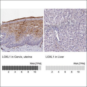 Anti-LOXL1 antibody produced in rabbit Prestige Antibodies&#174; Powered by Atlas Antibodies, affinity isolated antibody, buffered aqueous glycerol solution