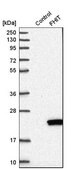 Anti-FHIT antibody produced in rabbit Prestige Antibodies&#174; Powered by Atlas Antibodies, affinity isolated antibody, buffered aqueous glycerol solution