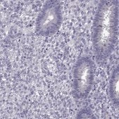 Anti-DUSP15 antibody produced in rabbit Prestige Antibodies&#174; Powered by Atlas Antibodies, affinity isolated antibody