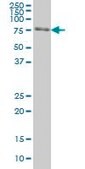 Monoclonal Anti-FKBP10 antibody produced in mouse clone 1C6, purified immunoglobulin, buffered aqueous solution