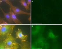 Anti-p-Paxillin-Tyr118 Antibody, clone 1E19 ZooMAb&#174; Rabbit Monoclonal recombinant, expressed in HEK 293 cells