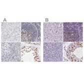 Anti-NASP antibody produced in rabbit Prestige Antibodies® Powered by Atlas Antibodies, affinity isolated antibody, buffered aqueous glycerol solution