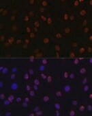 Anti-DiMethyl-Histone H3-K14 antibody produced in rabbit