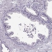 Anti-DNAAF1 Prestige Antibodies® Powered by Atlas Antibodies, affinity isolated antibody