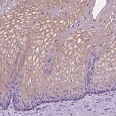 Anti-CLDN17 antibody produced in rabbit Prestige Antibodies&#174; Powered by Atlas Antibodies, affinity isolated antibody, buffered aqueous glycerol solution