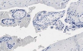 Anti-DAP Kinase 1 Antibody, clone 1J22 ZooMAb® Rabbit Monoclonal recombinant, expressed in HEK 293 cells