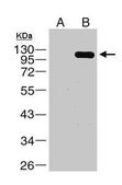 Anti-NS5 antibody produced in rabbit affinity isolated antibody, buffered aqueous solution